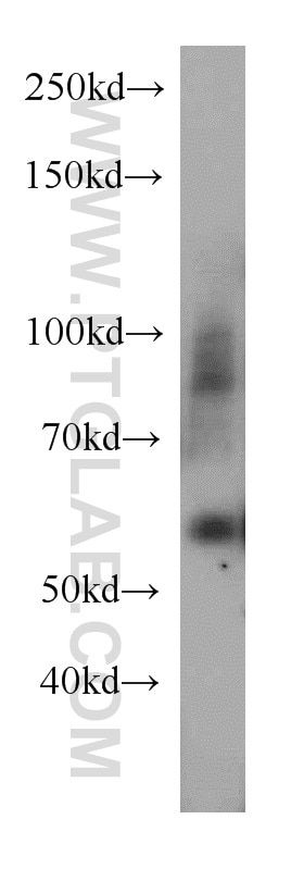 WB analysis of human testis using 12385-1-AP