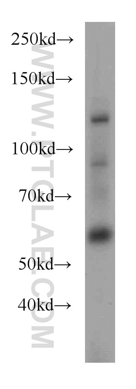 Western Blot (WB) analysis of human testis tissue using UBAP1 Polyclonal antibody (12385-1-AP)