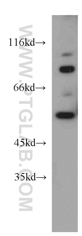 Western Blot (WB) analysis of mouse lung tissue using UBAP1 Polyclonal antibody (12385-1-AP)