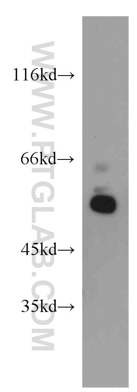 Western Blot (WB) analysis of mouse brain tissue using UBAP1 Polyclonal antibody (12385-1-AP)