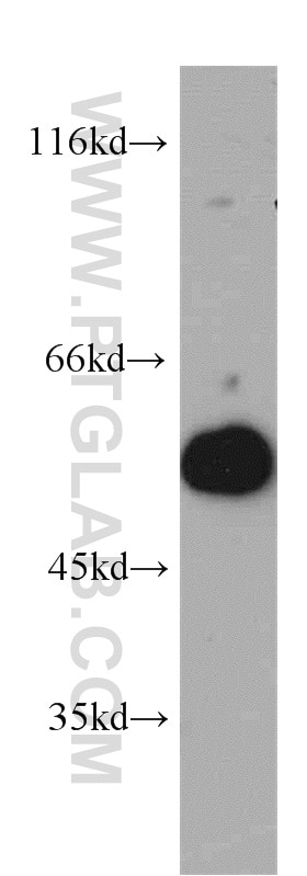 Western Blot (WB) analysis of A431 cells using UBAP1 Polyclonal antibody (12385-1-AP)
