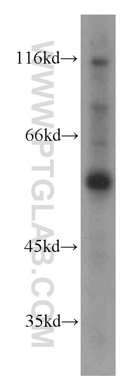 Western Blot (WB) analysis of human testis tissue using UBAP1 Polyclonal antibody (12385-1-AP)