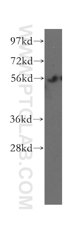 WB analysis of mouse thymus using 12385-1-AP