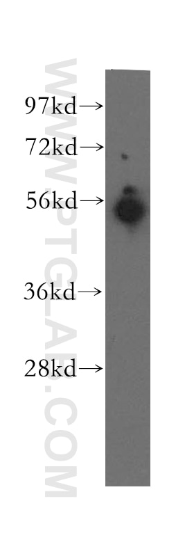 Western Blot (WB) analysis of human spleen tissue using UBAP1 Polyclonal antibody (12385-1-AP)
