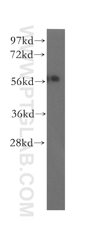 Western Blot (WB) analysis of mouse testis tissue using UBAP1 Polyclonal antibody (12385-1-AP)