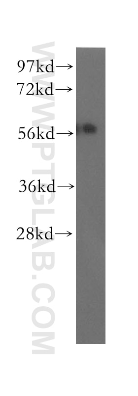 WB analysis of mouse testis using 12385-1-AP