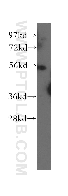 Western Blot (WB) analysis of Y79 cells using UBAP1 Polyclonal antibody (12385-1-AP)