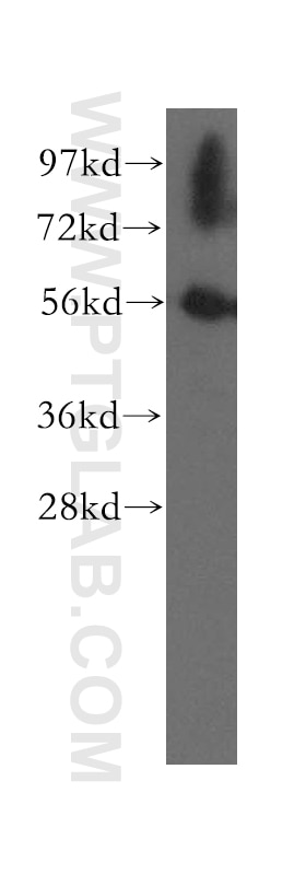Western Blot (WB) analysis of human lung tissue using UBAP1 Polyclonal antibody (12385-1-AP)