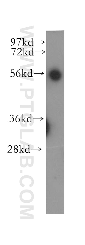 Western Blot (WB) analysis of human heart tissue using UBAP1 Polyclonal antibody (12385-1-AP)