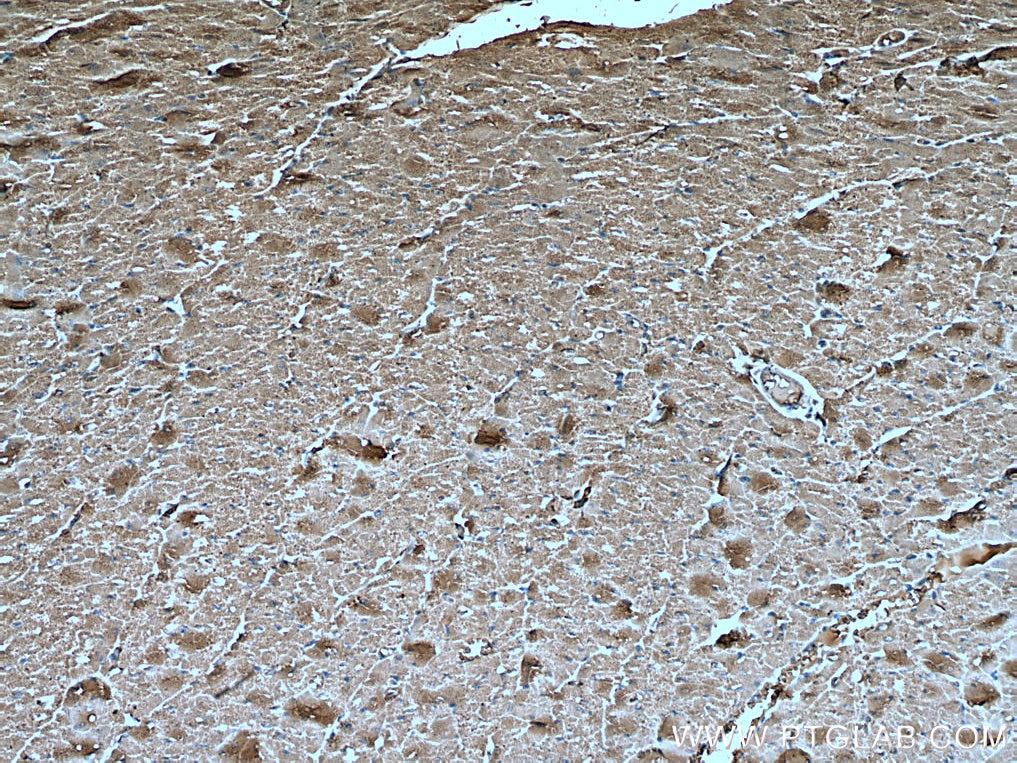 Immunohistochemistry (IHC) staining of human heart tissue using UBAP1 Monoclonal antibody (66993-1-Ig)