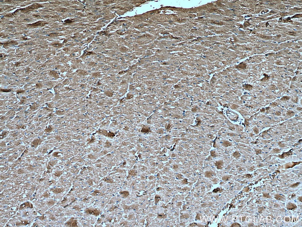 IHC staining of human heart using 66993-1-Ig