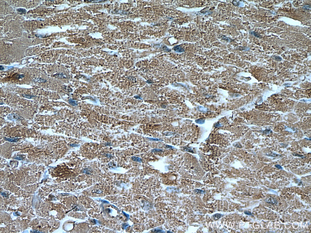Immunohistochemistry (IHC) staining of human heart tissue using UBAP1 Monoclonal antibody (66993-1-Ig)