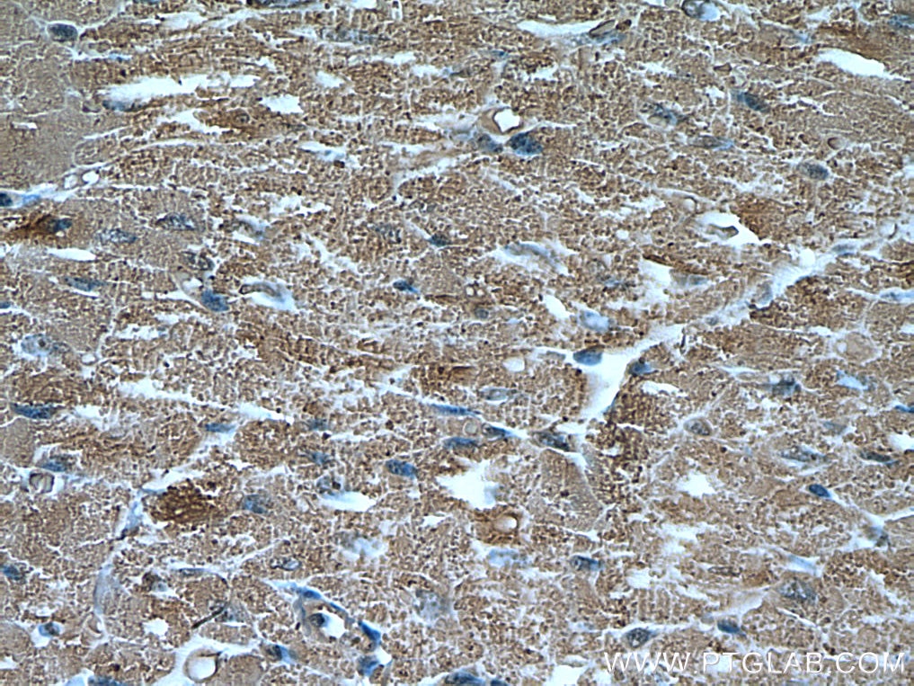 Immunohistochemistry (IHC) staining of human heart tissue using UBAP1 Monoclonal antibody (66993-1-Ig)