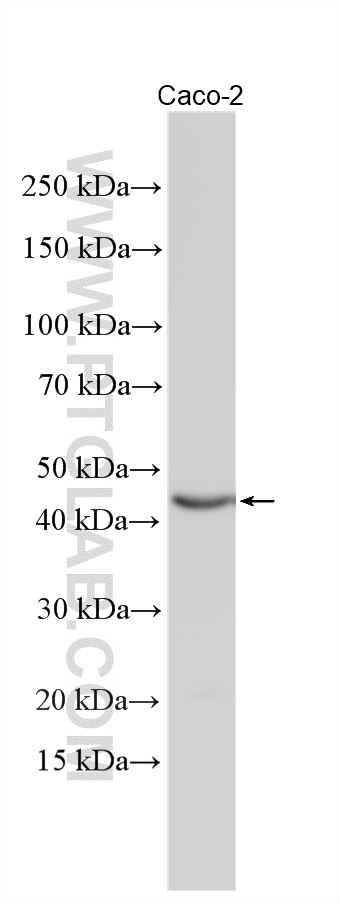 WB analysis using 31189-1-AP Western Blot (WB) analysis of various lysates using UBAP1L Polyclonal antibody (31189-1-AP)