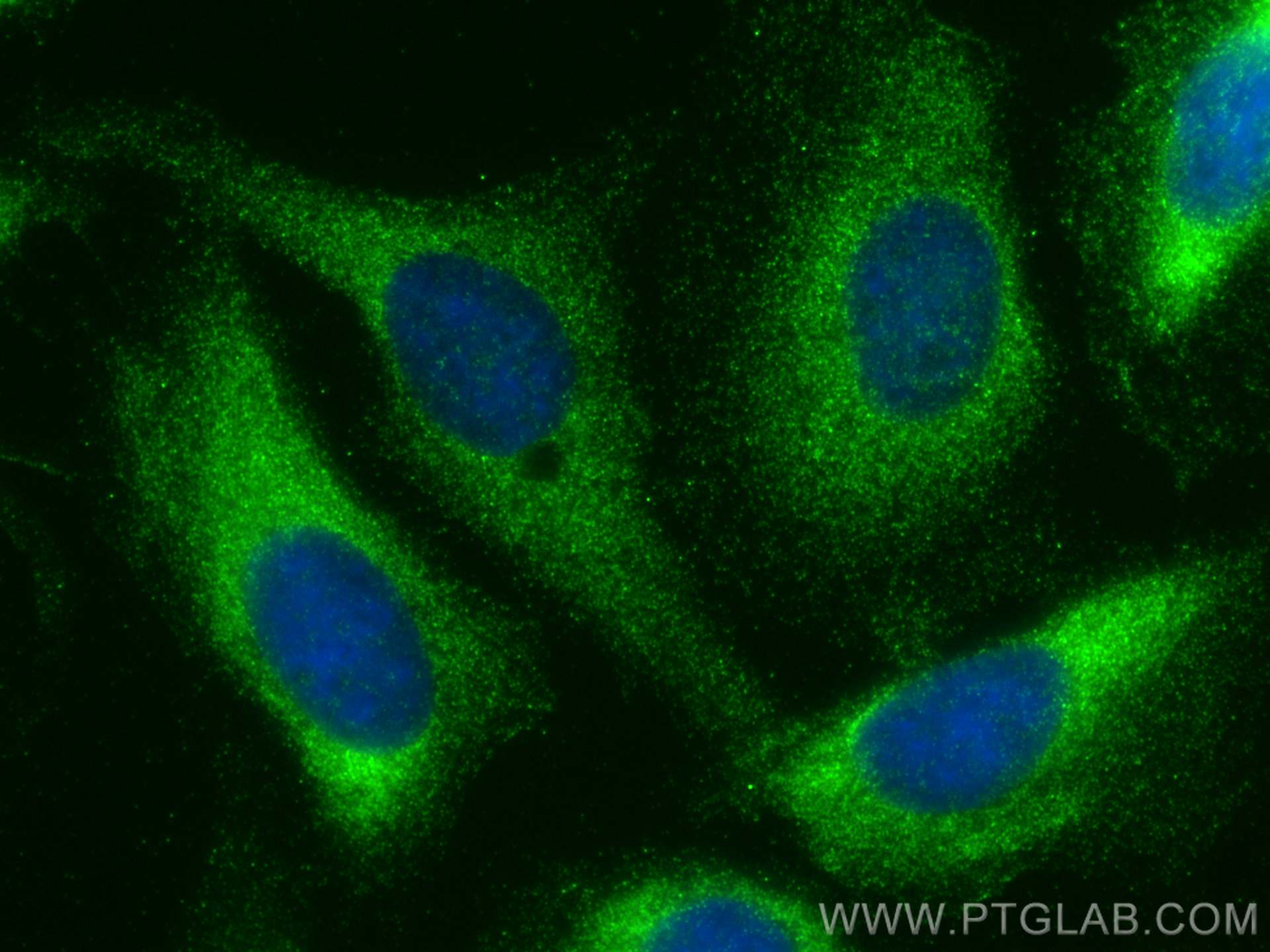 Immunofluorescence (IF) / fluorescent staining of U2OS cells using UBAP2 Polyclonal antibody (29628-1-AP)
