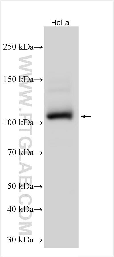 Western Blot (WB) analysis of various lysates using UBAP2 Polyclonal antibody (29628-1-AP)