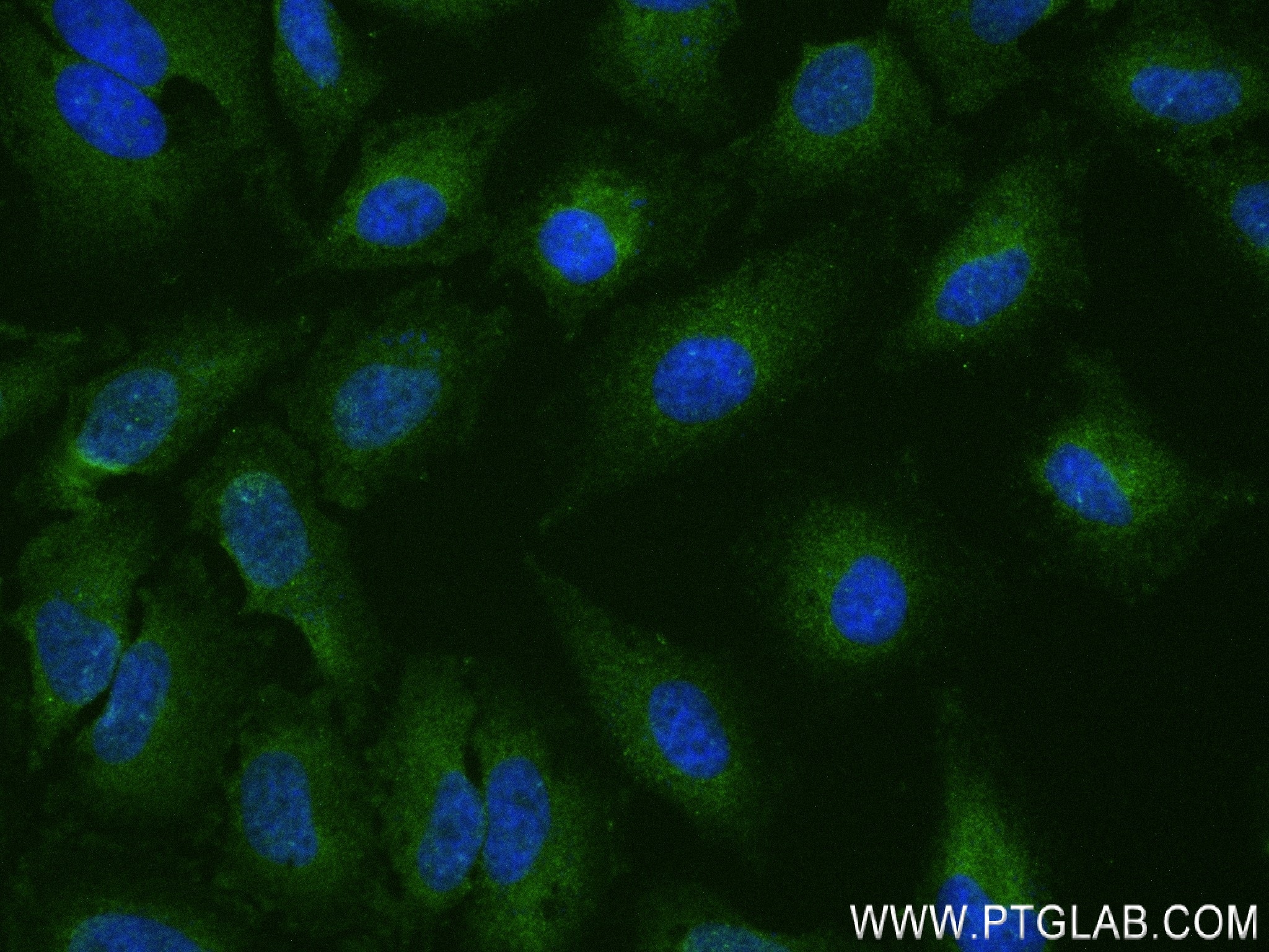 Immunofluorescence (IF) / fluorescent staining of HeLa cells using UBAP2 Recombinant antibody (83885-2-RR)
