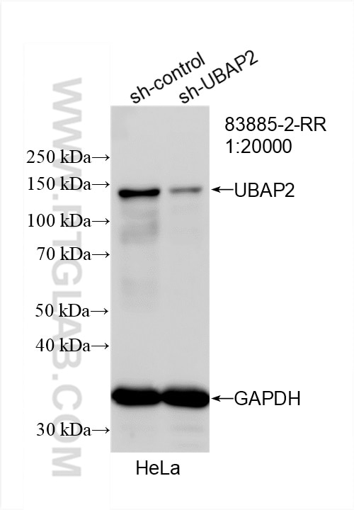 Western Blot (WB) analysis of HeLa cells using UBAP2 Recombinant antibody (83885-2-RR)