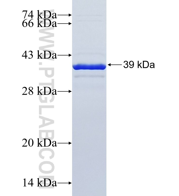 UBAP2 fusion protein Ag30572 SDS-PAGE
