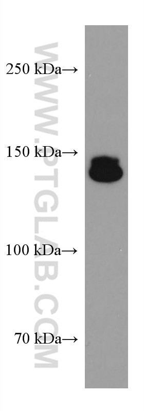 Western Blot (WB) analysis of K-562 cells using UBAP2L Monoclonal antibody (67588-1-Ig)