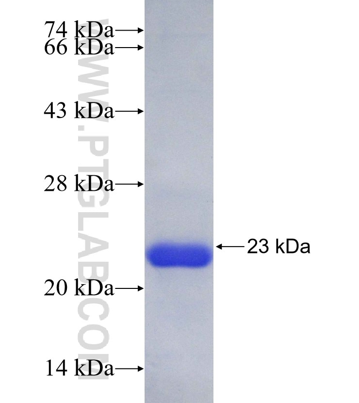 UBAP2L fusion protein Ag30125 SDS-PAGE