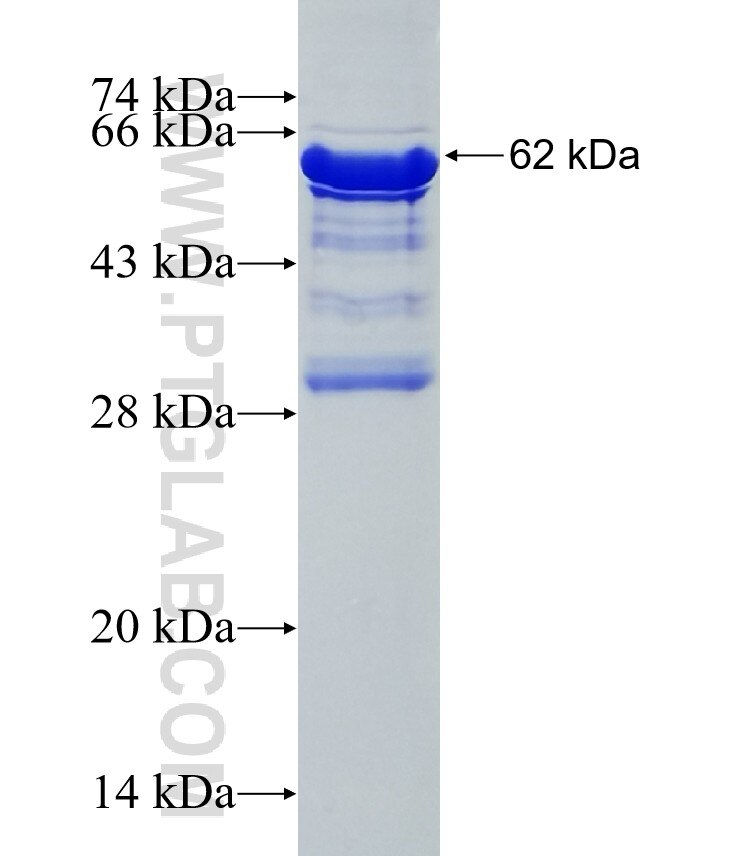 UBAP2L fusion protein Ag7715 SDS-PAGE