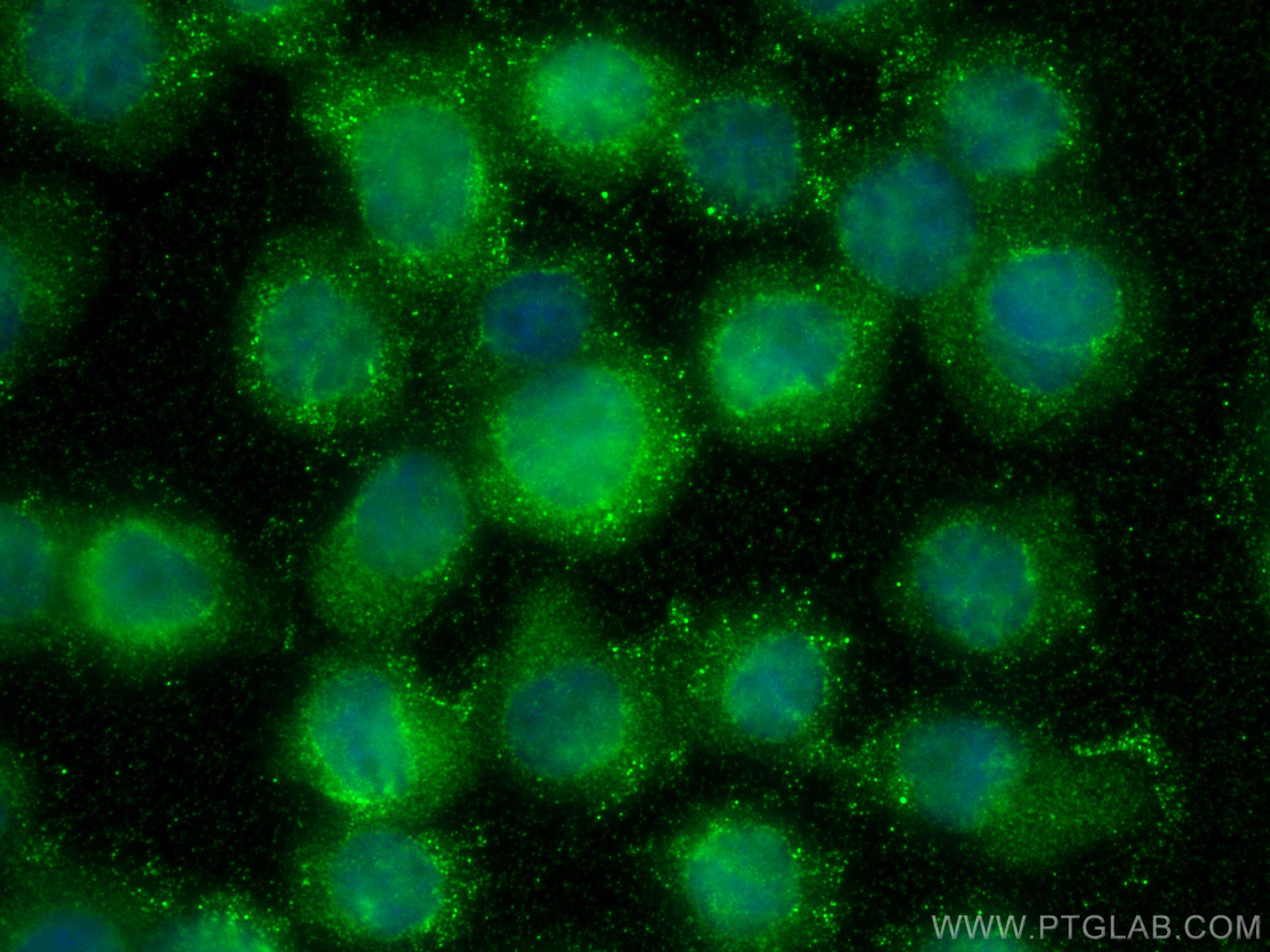 Immunofluorescence (IF) / fluorescent staining of THP-1 cells using UBASH3A-Specific Polyclonal antibody (15823-1-AP)