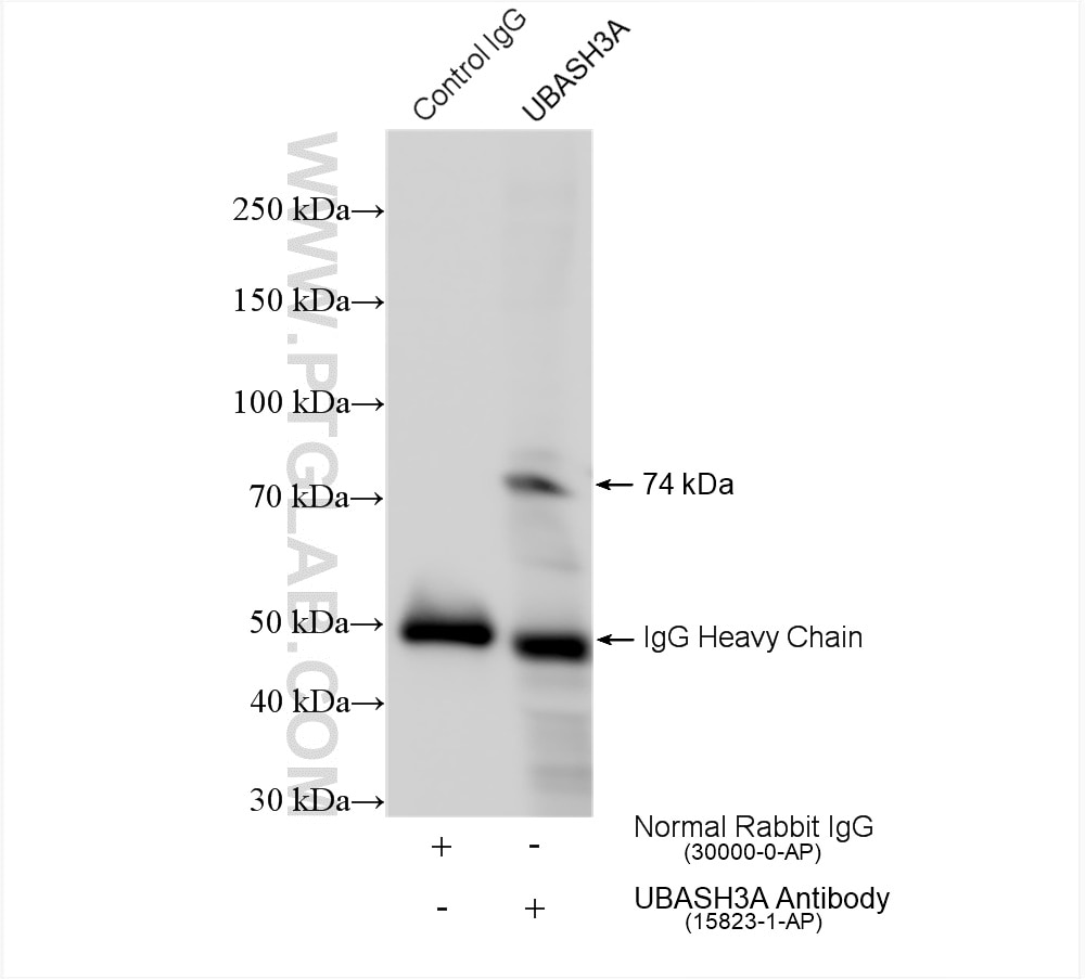 Immunoprecipitation (IP) experiment of mouse spleen tissue using UBASH3A-Specific Polyclonal antibody (15823-1-AP)