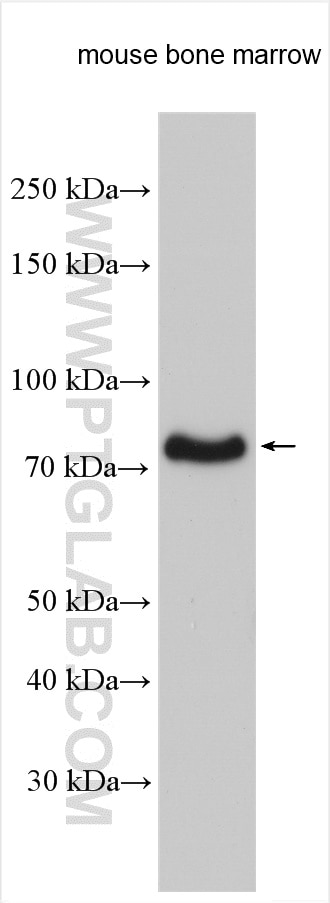 Western Blot (WB) analysis of various lysates using UBASH3A-Specific Polyclonal antibody (15823-1-AP)