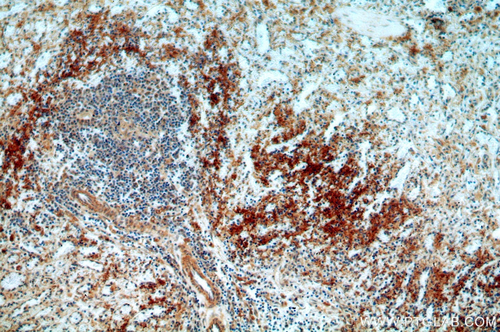Immunohistochemistry (IHC) staining of human spleen tissue using UBASH3B/STS 1 Polyclonal antibody (19563-1-AP)