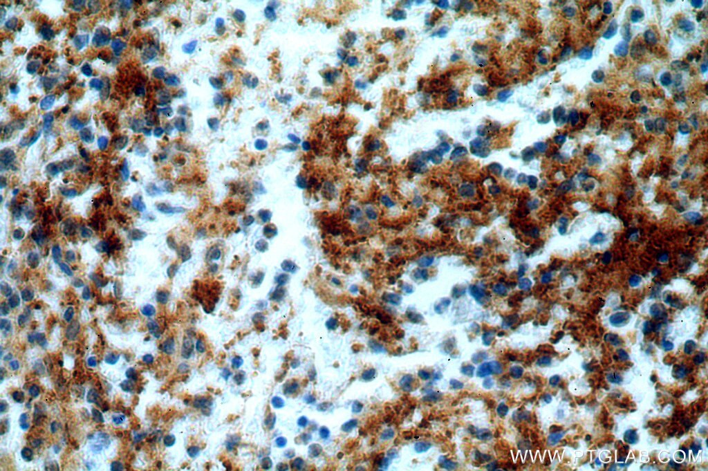 Immunohistochemistry (IHC) staining of human spleen tissue using UBASH3B/STS 1 Polyclonal antibody (19563-1-AP)