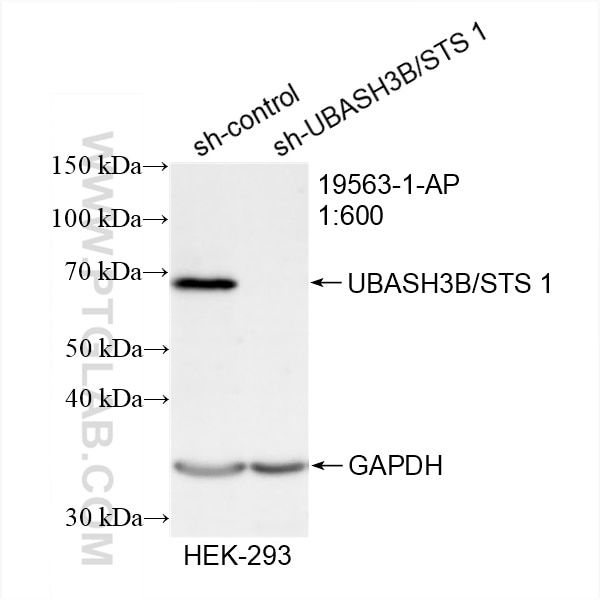 Western Blot (WB) analysis of HEK-293 cells using UBASH3B/STS 1 Polyclonal antibody (19563-1-AP)