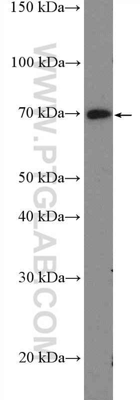 Western Blot (WB) analysis of HEK-293 cells using UBASH3B/STS 1 Polyclonal antibody (19563-1-AP)