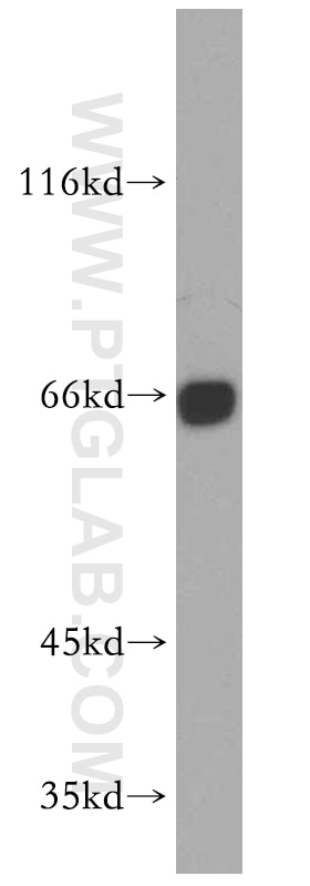 Western Blot (WB) analysis of mouse lung tissue using UBASH3B/STS 1 Polyclonal antibody (19563-1-AP)