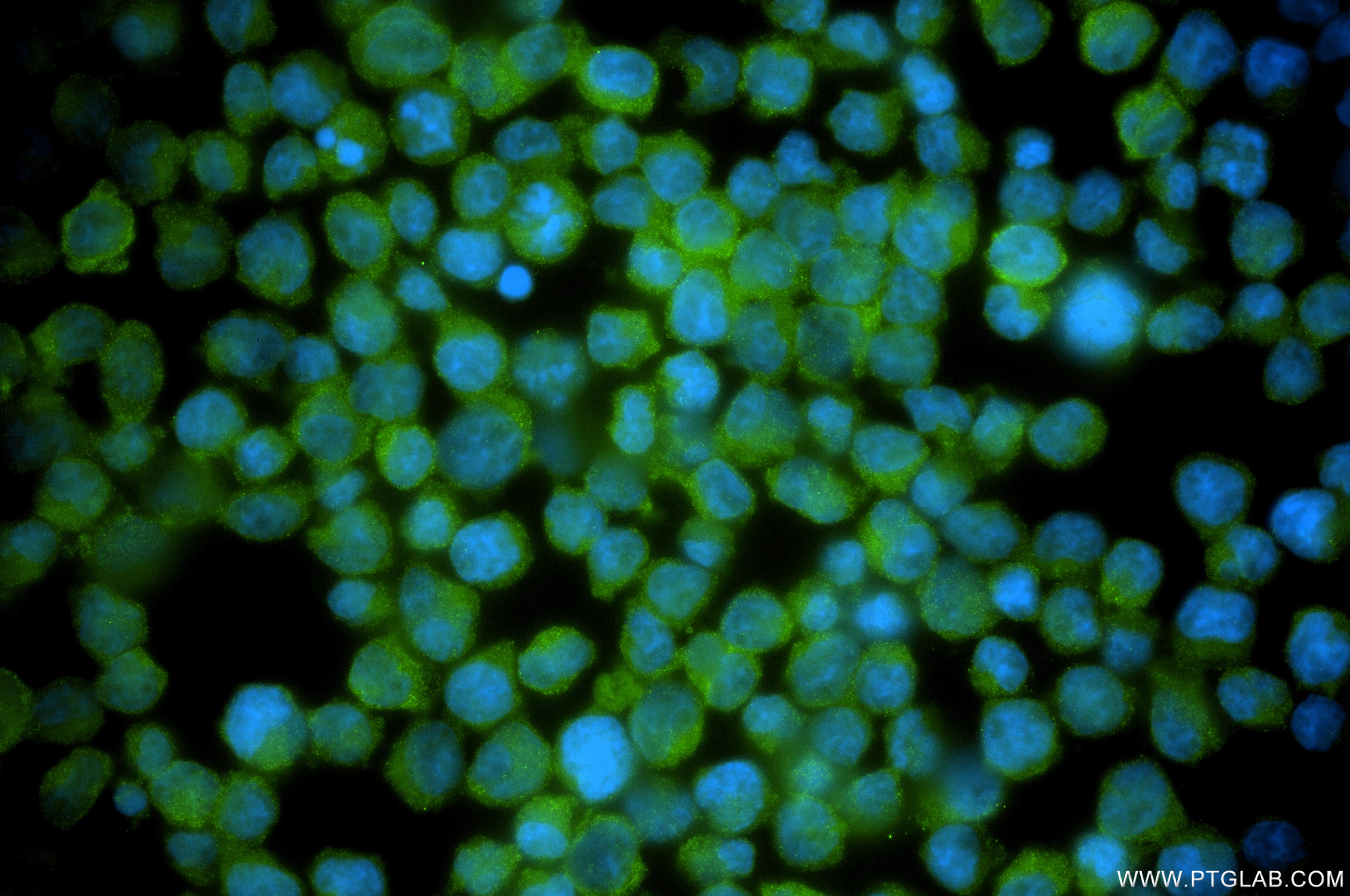 Immunofluorescence (IF) / fluorescent staining of Jurkat cells using UBASH3B Recombinant monoclonal antibody (85904-1-RR)