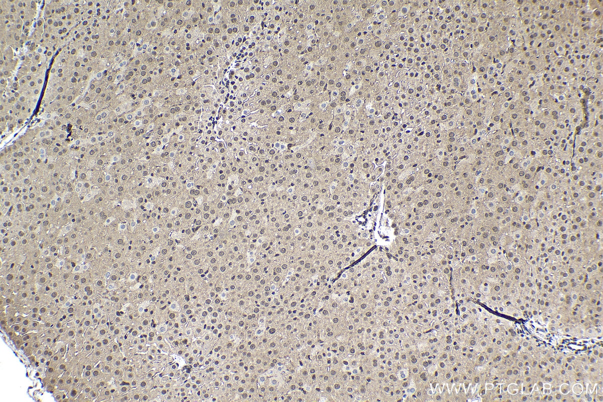 Immunohistochemistry (IHC) staining of mouse liver tissue using UBC Polyclonal antibody (10457-1-AP)