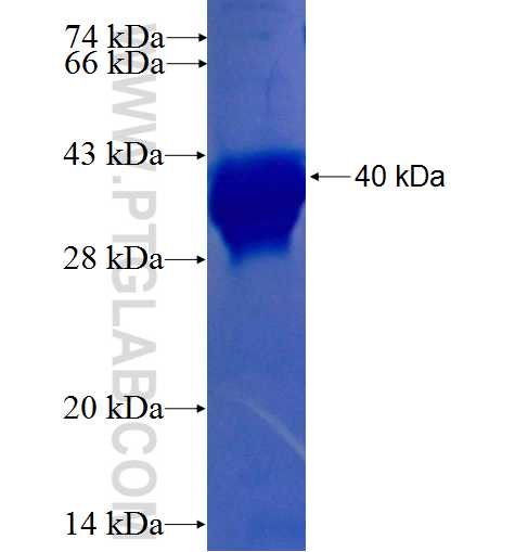 UBC fusion protein Ag0711 SDS-PAGE