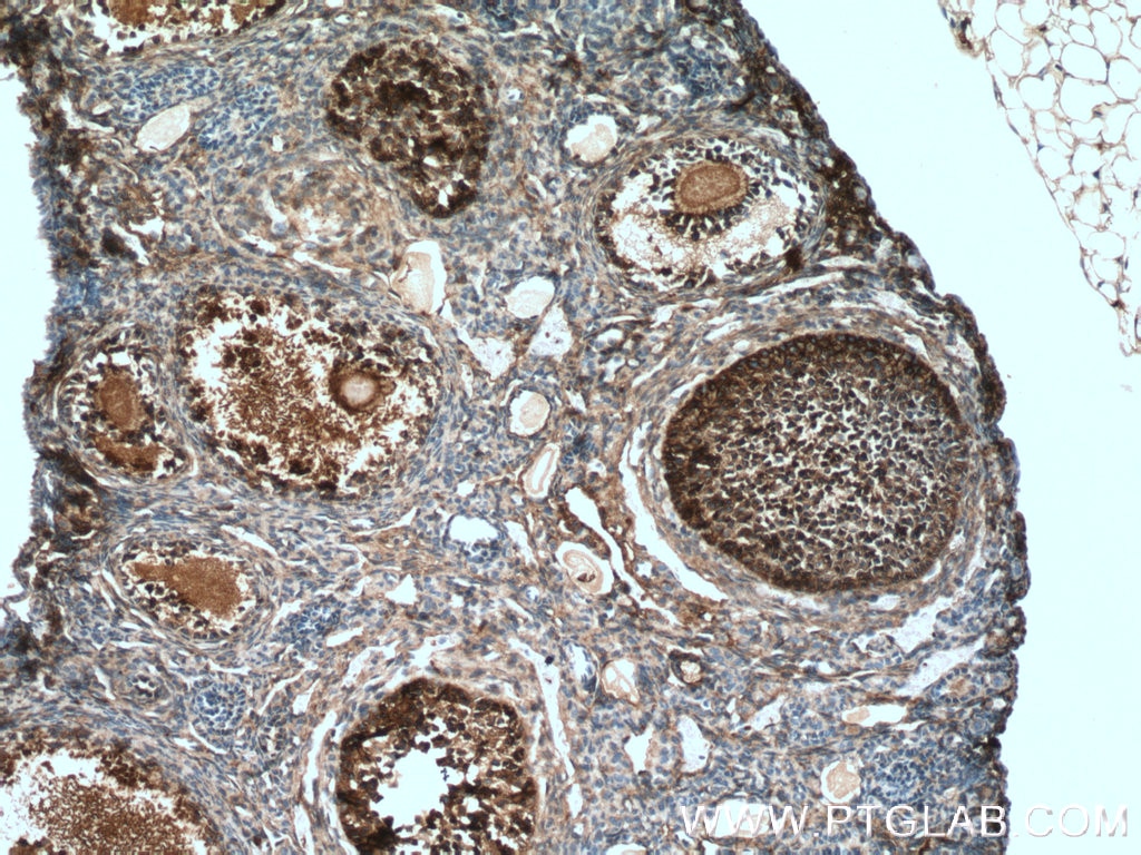 Immunohistochemistry (IHC) staining of mouse ovary tissue using UBC12 Polyclonal antibody (14520-1-AP)