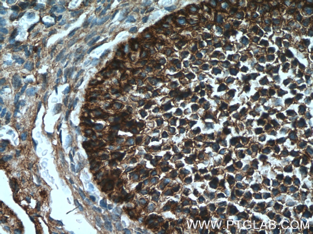 Immunohistochemistry (IHC) staining of mouse ovary tissue using UBC12 Polyclonal antibody (14520-1-AP)