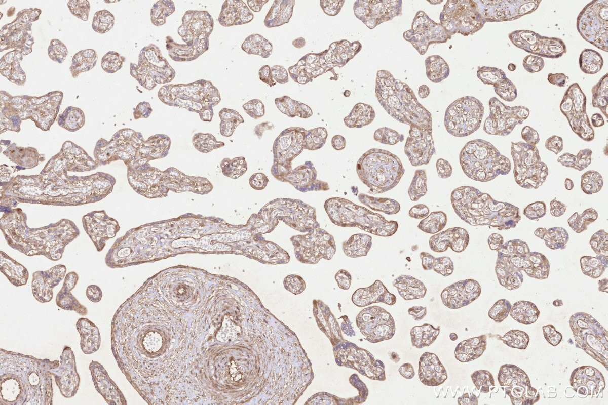 Immunohistochemistry (IHC) staining of human placenta tissue using UBC12 Polyclonal antibody (14520-1-AP)