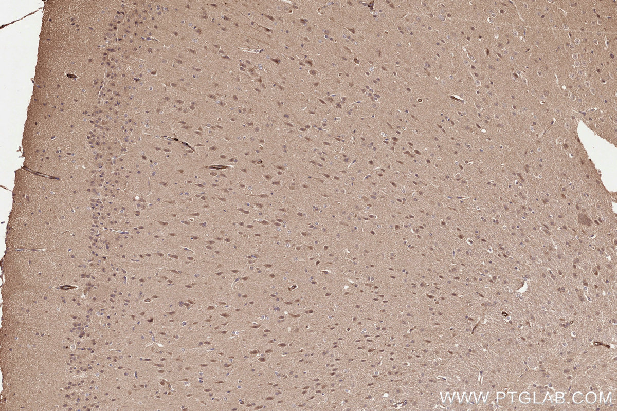 Immunohistochemistry (IHC) staining of rat brain tissue using UBC12 Polyclonal antibody (14520-1-AP)