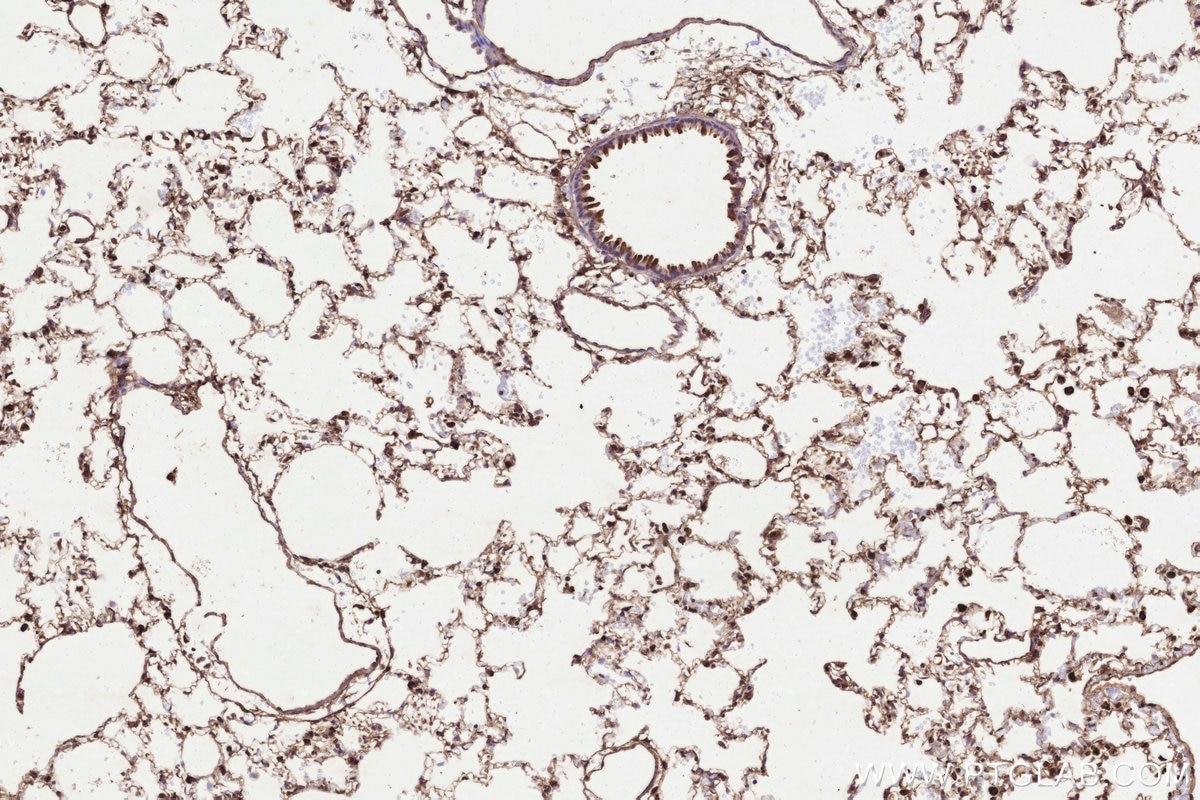 Immunohistochemistry (IHC) staining of rat lung tissue using UBC12 Polyclonal antibody (14520-1-AP)