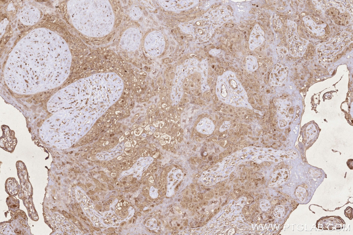 Immunohistochemistry (IHC) staining of human placenta tissue using UBC12 Polyclonal antibody (14520-1-AP)