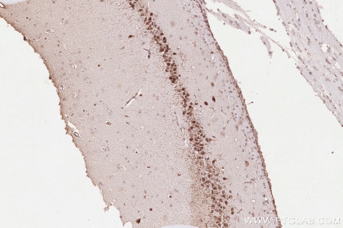 Immunohistochemistry (IHC) staining of rat brain tissue using UBC12 Polyclonal antibody (14520-1-AP)