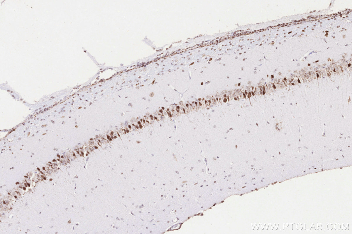 Immunohistochemistry (IHC) staining of rat brain tissue using UBC12 Polyclonal antibody (14520-1-AP)