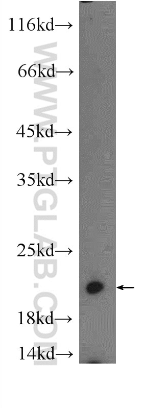 UBC12 Polyclonal antibody