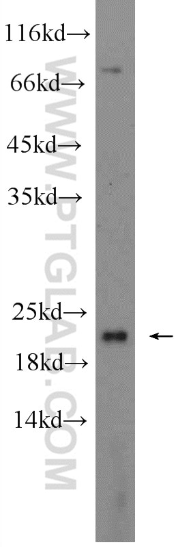 Western Blot (WB) analysis of L02 cells using UBC12 Polyclonal antibody (14520-1-AP)