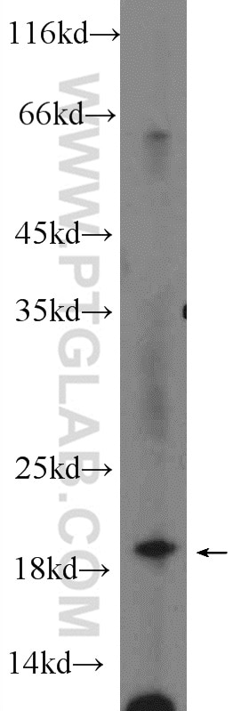 Western Blot (WB) analysis of SMMC-7721 cells using UBC12 Polyclonal antibody (14520-1-AP)