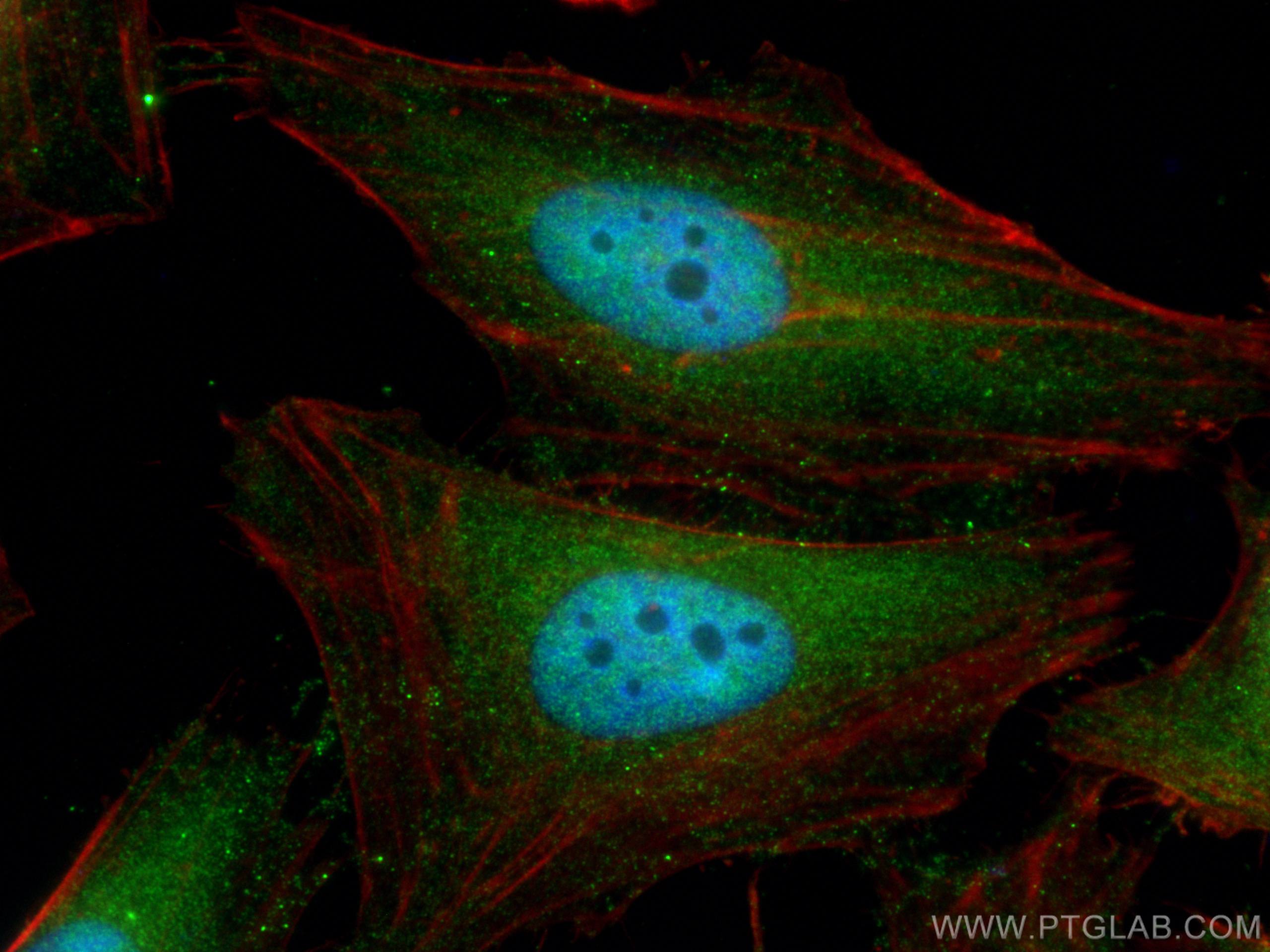 Immunofluorescence (IF) / fluorescent staining of HeLa cells using UBC12 Monoclonal antibody (67482-1-Ig)