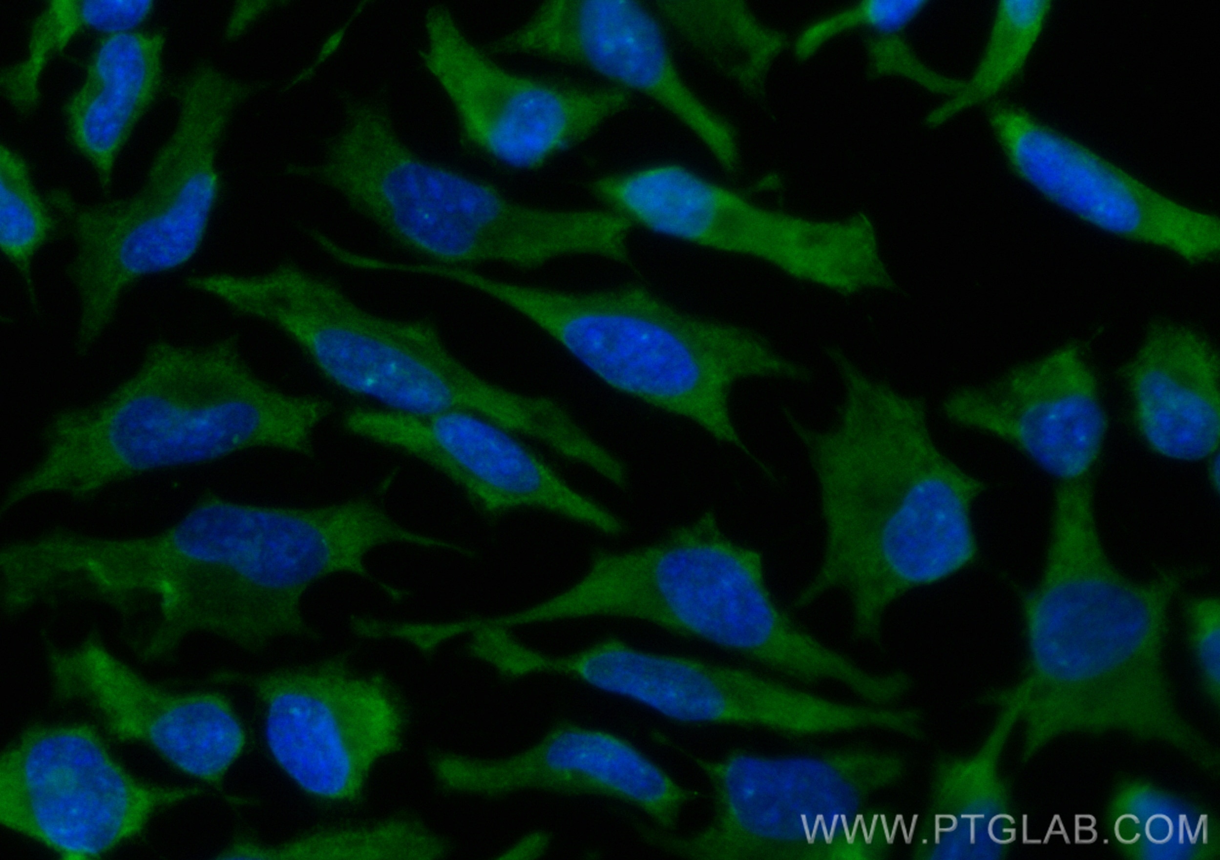 Immunofluorescence (IF) / fluorescent staining of HeLa cells using CoraLite® Plus 488-conjugated UBC12 Monoclonal ant (CL488-67482)